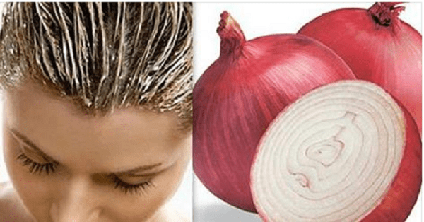 Ginger And Onion Juice For Hair Growth - Khushi Hamesha
